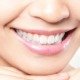 Gros plan sur un sourire montrant des dents blanches et bien alignées après un traitement dentaire.